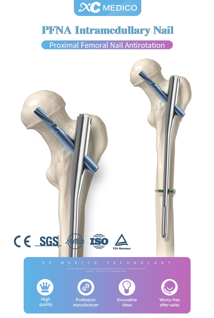 Anti-Rotation Proximal Femoral Intramedullary Nail Pfna Blade Screws